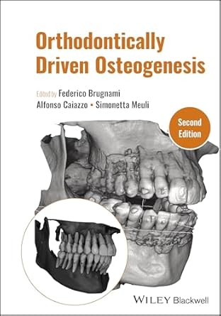 Orthodontically Driven Osteogenesis 2nd Edition